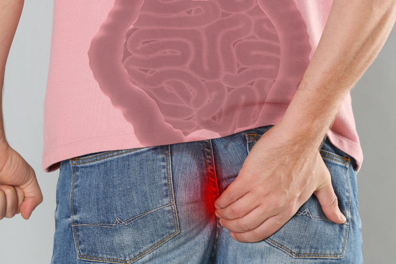 Piles Treatment